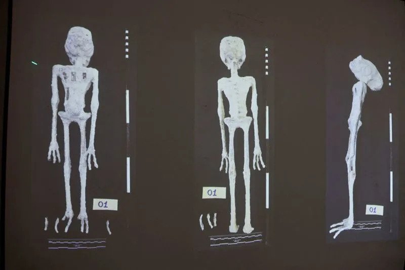 Peru Alien Mummies X-Ray